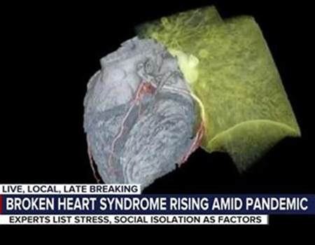 Broken Heart Syndrome is Rising during Pandemic